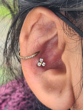 Accesorio trinity c/ rosca titanio ASTM F136 -Accesorio trinity zirconia blanco